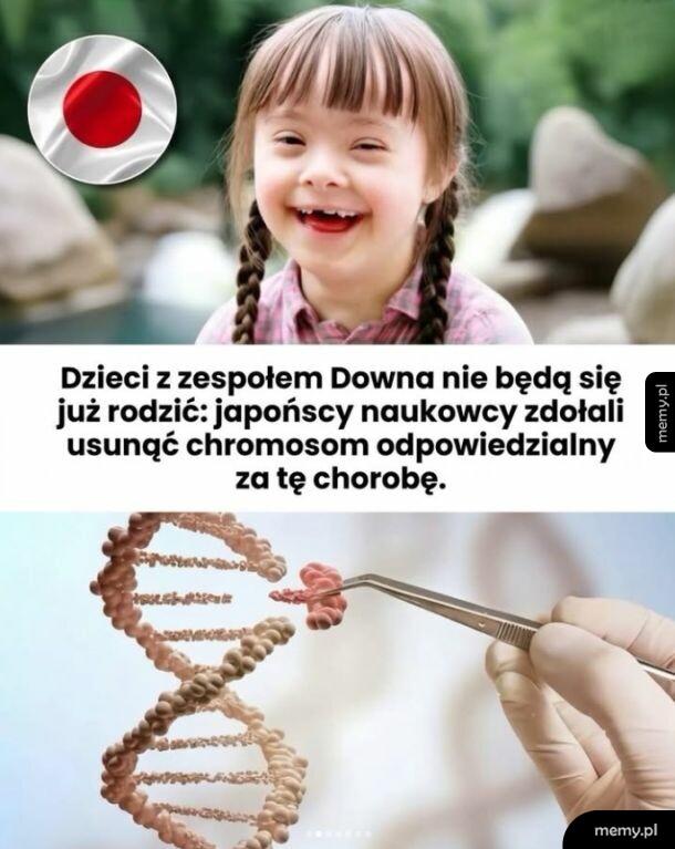 Dziecko z zespołem Downa i ilustracja DNA.