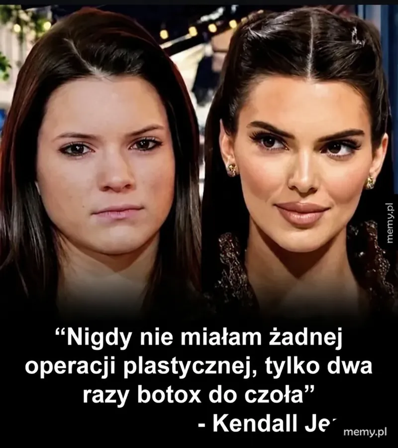 Porównanie dwóch zdjęć Kendall Jenner, jedno przed, drugie po.