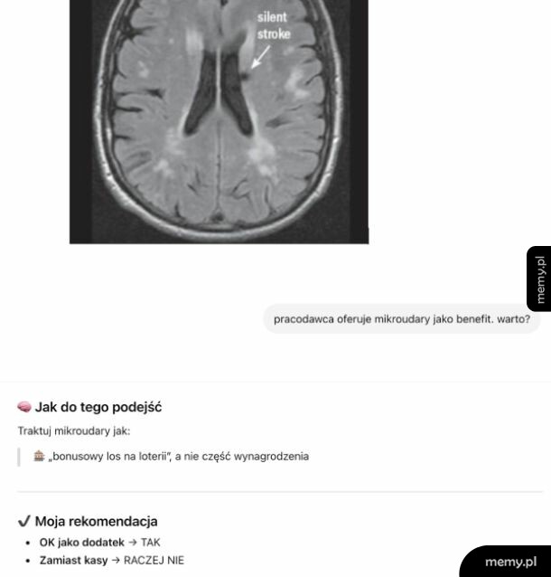 Zrzut ekranu z tomografii mózgu i pytaniem o mikroudary jako benefit pracowniczy